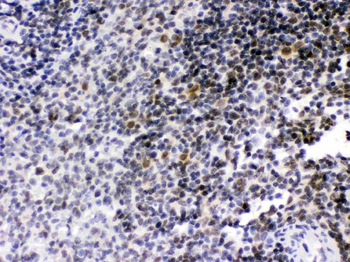 RAG2 Rabbit Polyclonal Antibody