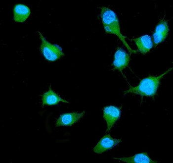 RALB Rabbit Polyclonal Antibody