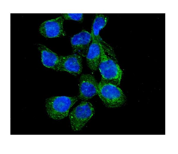 RASA1 Rabbit Polyclonal Antibody
