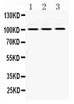RASA1 Rabbit Polyclonal Antibody