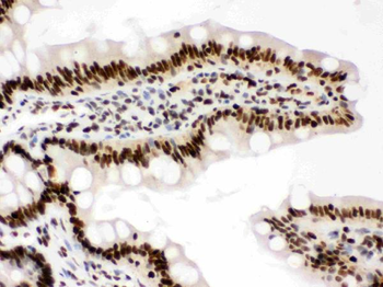 RbAp48/RBBP4 Antibody