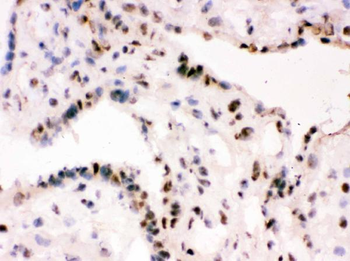 RbAp48/RBBP4 Antibody