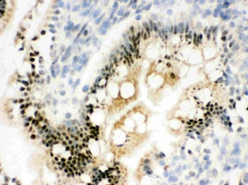 RbAp48/RBBP4 Antibody
