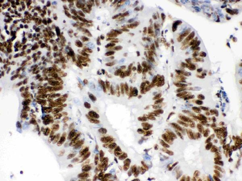 RbAp48/RBBP4 Antibody