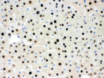 RbAp48/RBBP4 Antibody