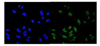 ROC1/RBX1 Antibody