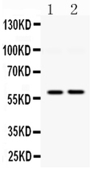 DGAT1 Rabbit Polyclonal Antibody