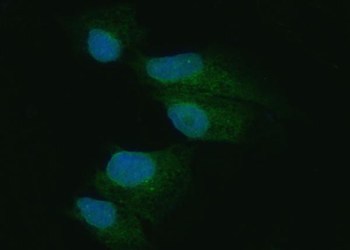 PKR/EIF2AK2 Rabbit Polyclonal Antibody