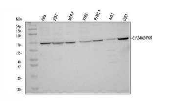 PKR/EIF2AK2 Rabbit Polyclonal Antibody