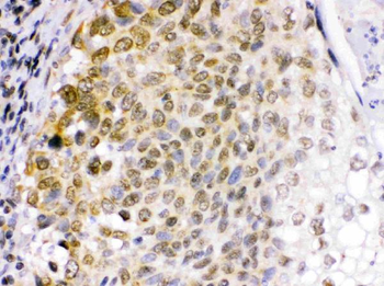 EME1 Rabbit Polyclonal Antibody