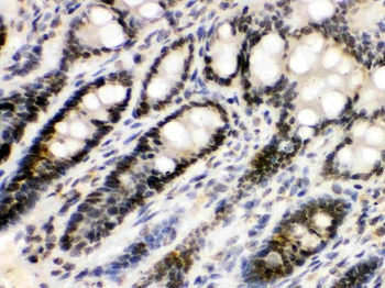 EME1 Rabbit Polyclonal Antibody