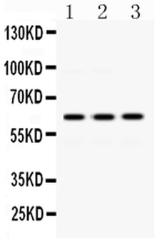 EME1 Rabbit Polyclonal Antibody