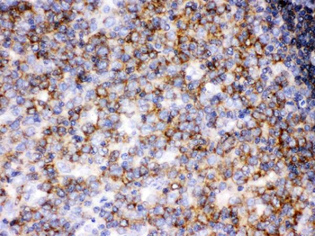Lck Rabbit Polyclonal Antibody