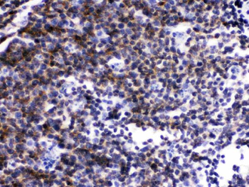 Lck Rabbit Polyclonal Antibody