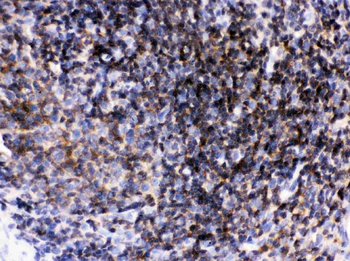 Lck Rabbit Polyclonal Antibody