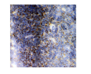Lck Rabbit Polyclonal Antibody
