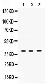 DNA Polymerase beta/POLB Rabbit Polyclonal Antibody