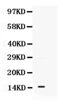 S100A11 Rabbit Polyclonal Antibody