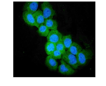 SULT2B1 Rabbit Polyclonal Antibody