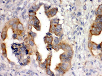 SULT2B1 Rabbit Polyclonal Antibody