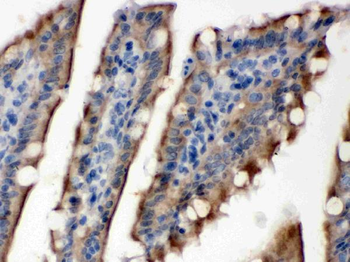 SULT2B1 Rabbit Polyclonal Antibody