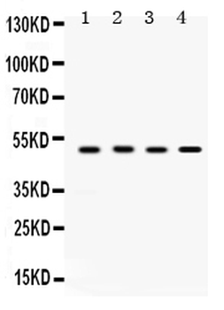 SULT2B1 Rabbit Polyclonal Antibody