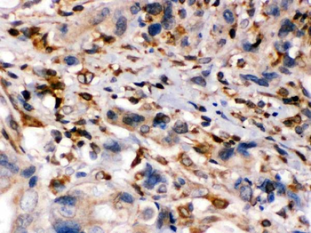 TAP1 Rabbit Polyclonal Antibody