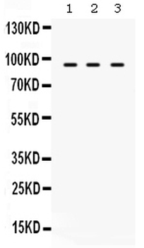 TAP1 Rabbit Polyclonal Antibody