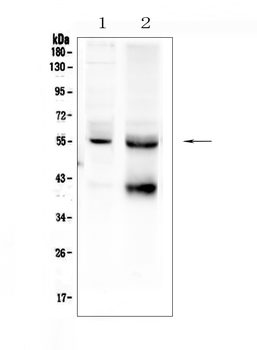 TGF beta Receptor I/TGFBR1 Antibody