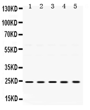 TIMP2 Rabbit Polyclonal Antibody