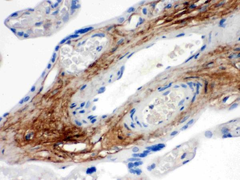 TNXB Rabbit Polyclonal Antibody