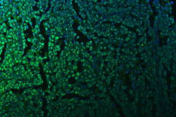 KAP1/TRIM28 Antibody