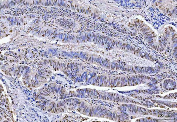 KAP1/TRIM28 Antibody