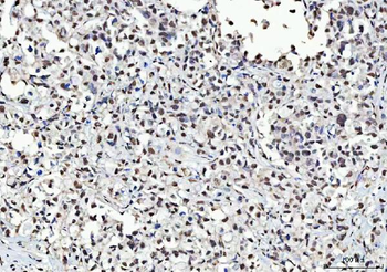 KAP1/TRIM28 Antibody