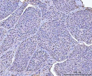 KAP1/TRIM28 Antibody