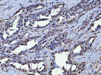 KAP1/TRIM28 Antibody