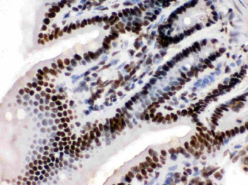 KAP1/TRIM28 Antibody