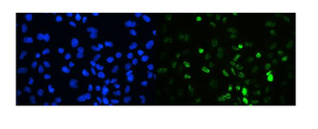 TIF1 gamma/TRIM33 Rabbit Polyclonal Antibody