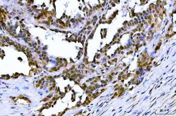 TIF1 gamma/TRIM33 Rabbit Polyclonal Antibody