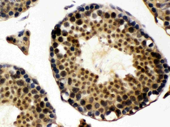 UBE1C/UBA3 Rabbit Polyclonal Antibody