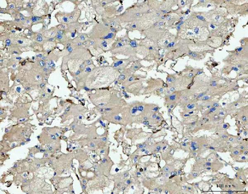 CD14 Rabbit Polyclonal Antibody