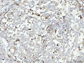 CD14 Rabbit Polyclonal Antibody