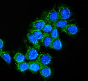 Cathepsin D/CTSD Rabbit Polyclonal Antibody