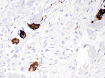 Cathepsin K/CTSK Rabbit Polyclonal Antibody