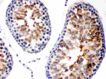 Smac/Diablo Rabbit Polyclonal Antibody