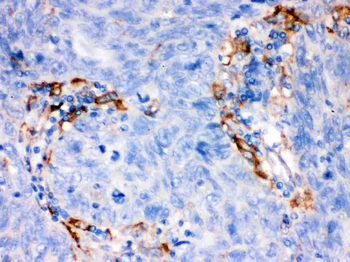 FCGRT Rabbit Polyclonal Antibody