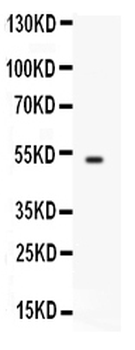 FCGRT Rabbit Polyclonal Antibody