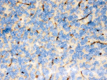 FCGRT Rabbit Polyclonal Antibody