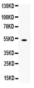 FCGRT Rabbit Polyclonal Antibody
