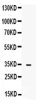 FGF23 Rabbit Polyclonal Antibody